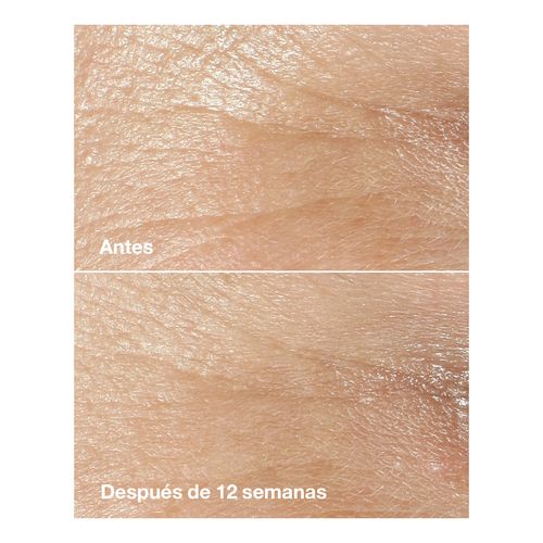 Smart Clinical Repair Wrinkle Correcting Cream Estuche